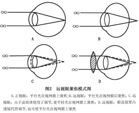 E读